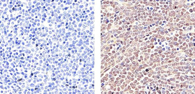 STAT5 beta Antibody in Immunohistochemistry (Paraffin) (IHC (P))