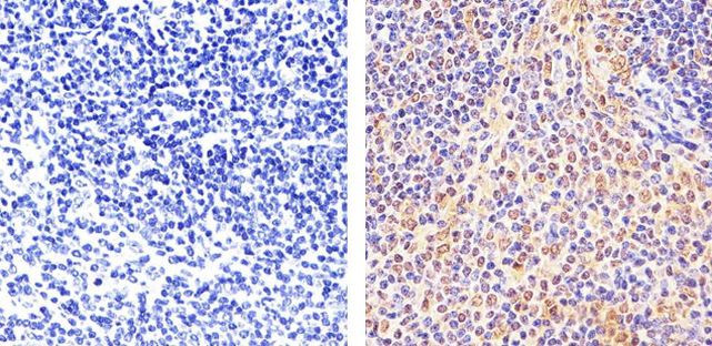 STAT5 beta Antibody in Immunohistochemistry (Paraffin) (IHC (P))