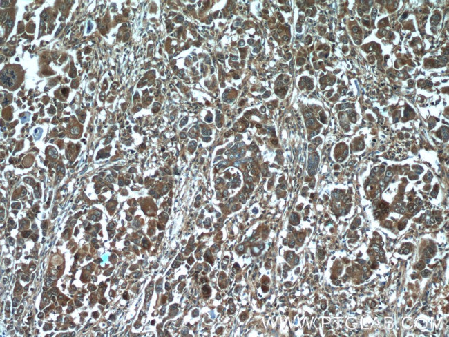 HMGCR Antibody in Immunohistochemistry (Paraffin) (IHC (P))