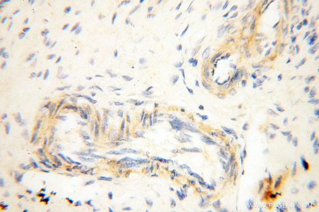 P2RX4 Antibody in Immunohistochemistry (Paraffin) (IHC (P))