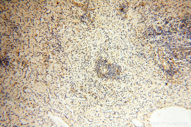 P2RX4 Antibody in Immunohistochemistry (Paraffin) (IHC (P))