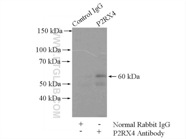 P2RX4 Antibody in Immunoprecipitation (IP)