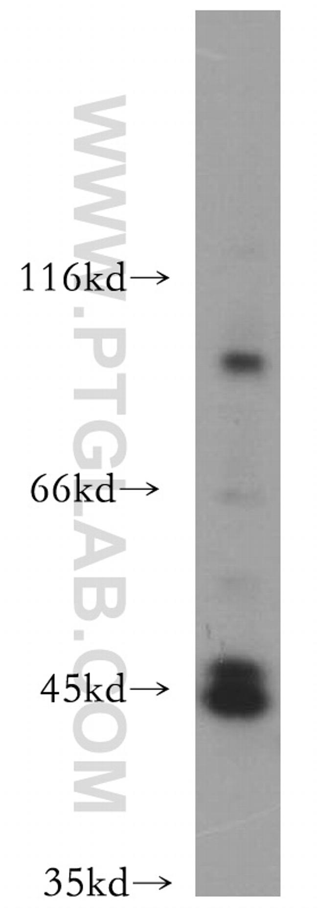 ACTL7B Antibody in Western Blot (WB)