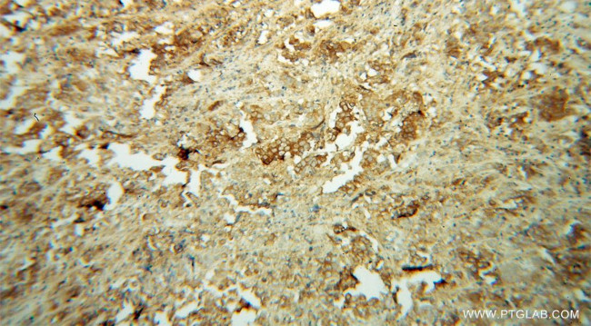 ACTL7B Antibody in Immunohistochemistry (Paraffin) (IHC (P))