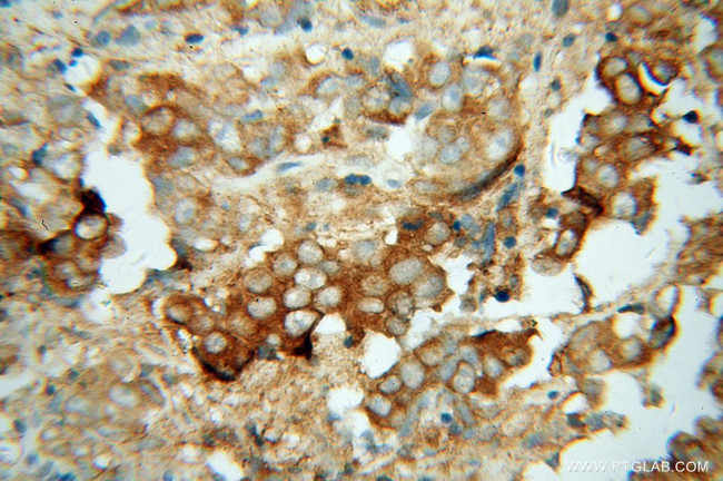 ACTL7B Antibody in Immunohistochemistry (Paraffin) (IHC (P))