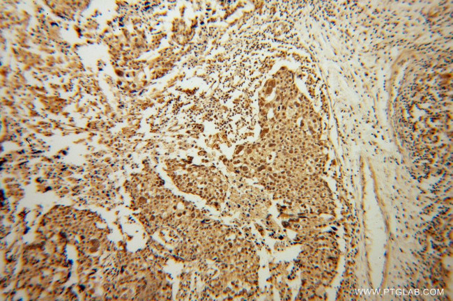 MSY2 Antibody in Immunohistochemistry (Paraffin) (IHC (P))