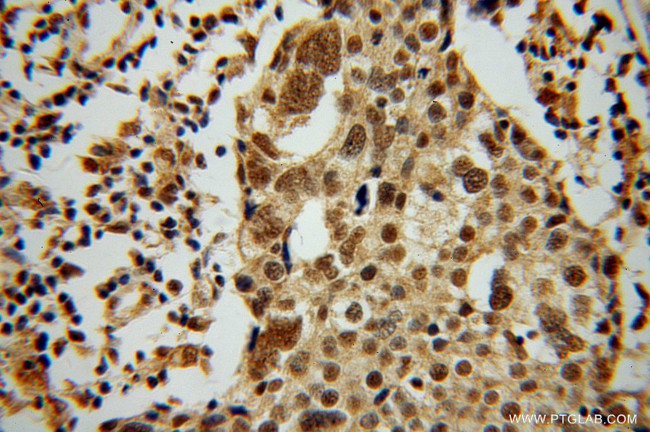 MSY2 Antibody in Immunohistochemistry (Paraffin) (IHC (P))