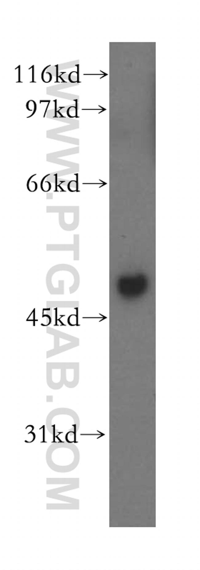 MSY2 Antibody in Western Blot (WB)