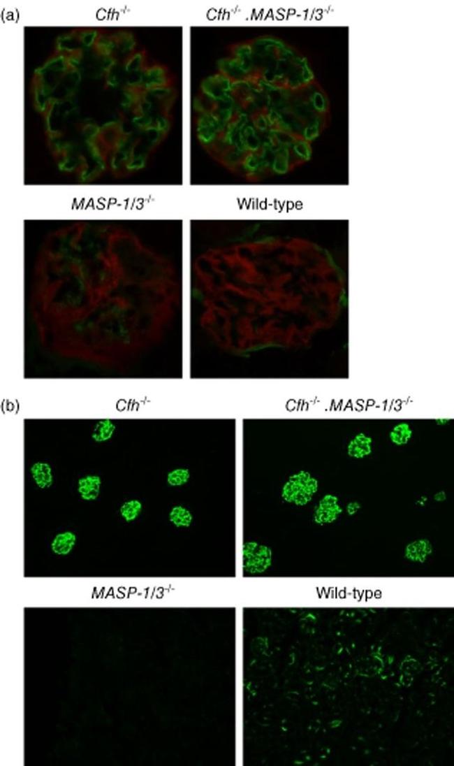 Podoplanin Antibody in Immunohistochemistry (IHC)