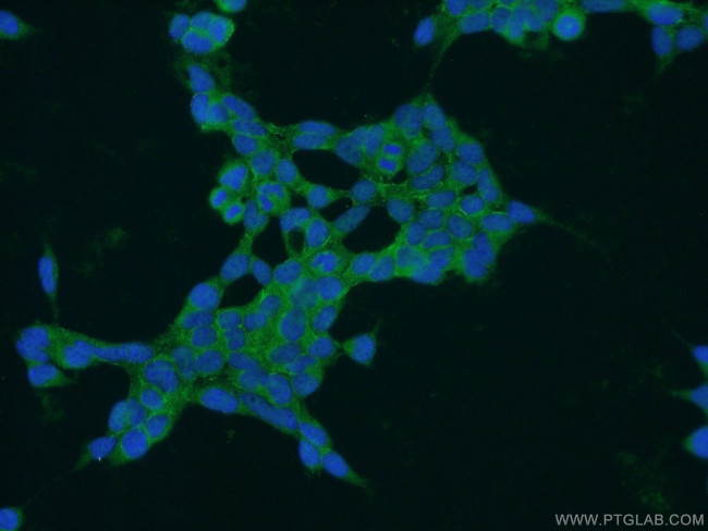 PAK6 Antibody in Immunocytochemistry (ICC/IF)