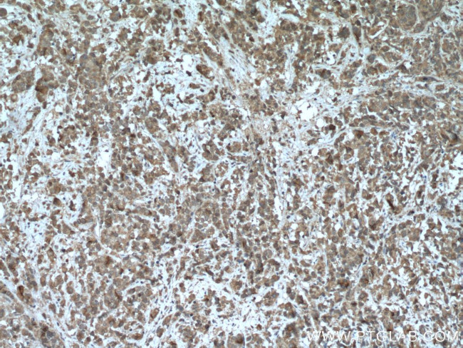 PAK6 Antibody in Immunohistochemistry (Paraffin) (IHC (P))