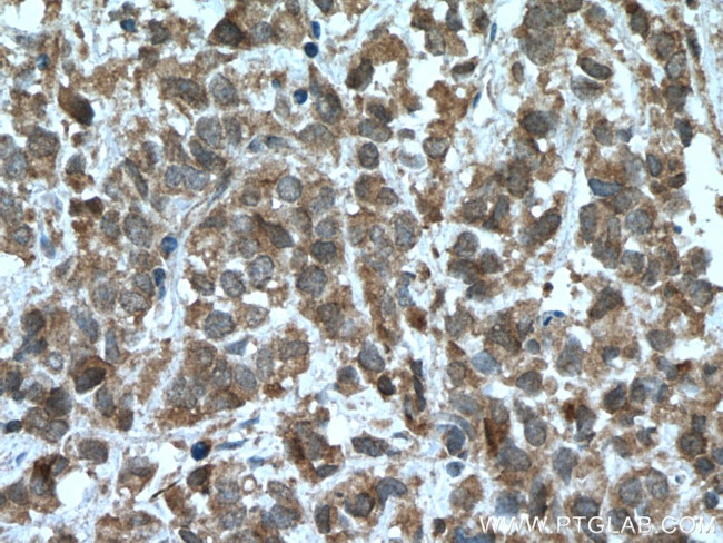 PAK6 Antibody in Immunohistochemistry (Paraffin) (IHC (P))