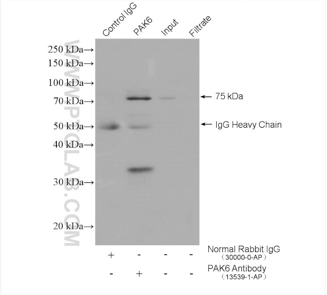 PAK6 Antibody in Immunoprecipitation (IP)