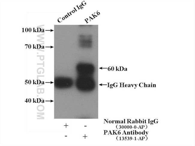 PAK6 Antibody in Immunoprecipitation (IP)