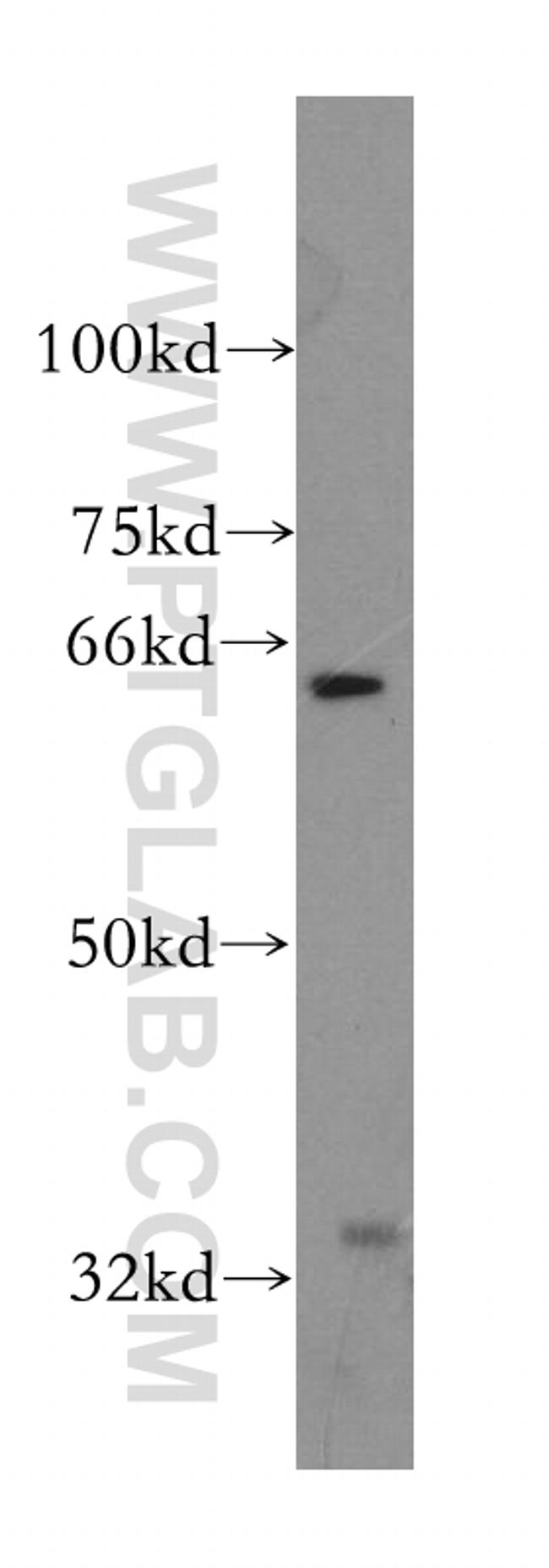 PAK6 Antibody in Western Blot (WB)