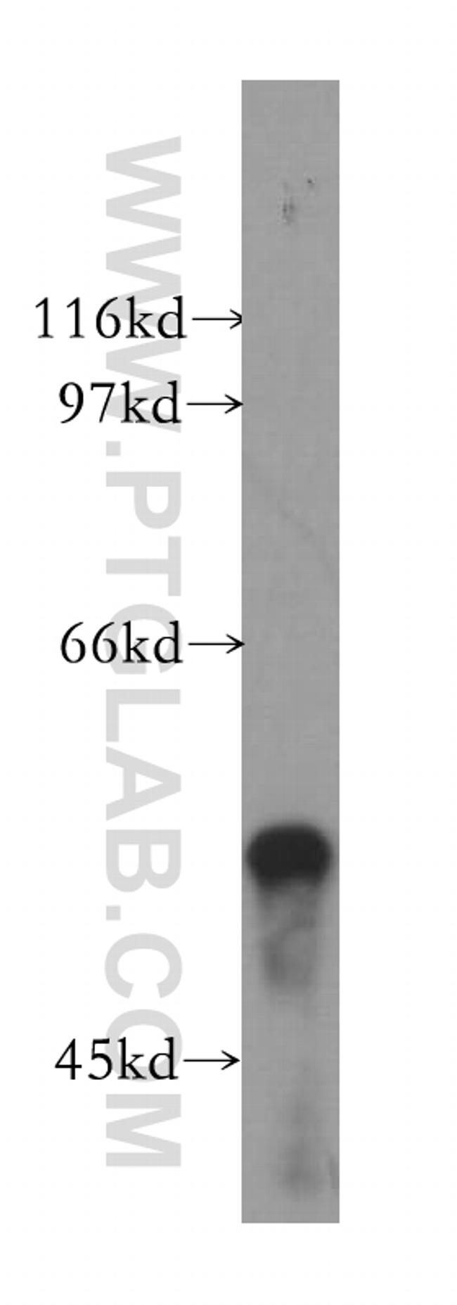 TBL1X Antibody in Western Blot (WB)