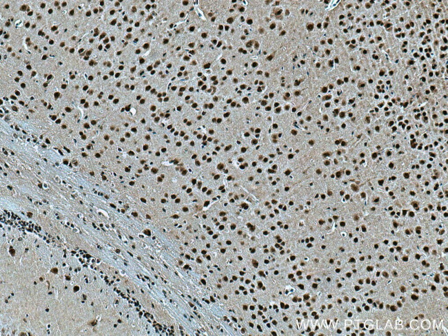 TBL1X Antibody in Immunohistochemistry (Paraffin) (IHC (P))