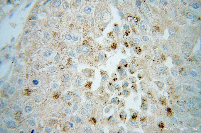 CROT Antibody in Immunohistochemistry (Paraffin) (IHC (P))