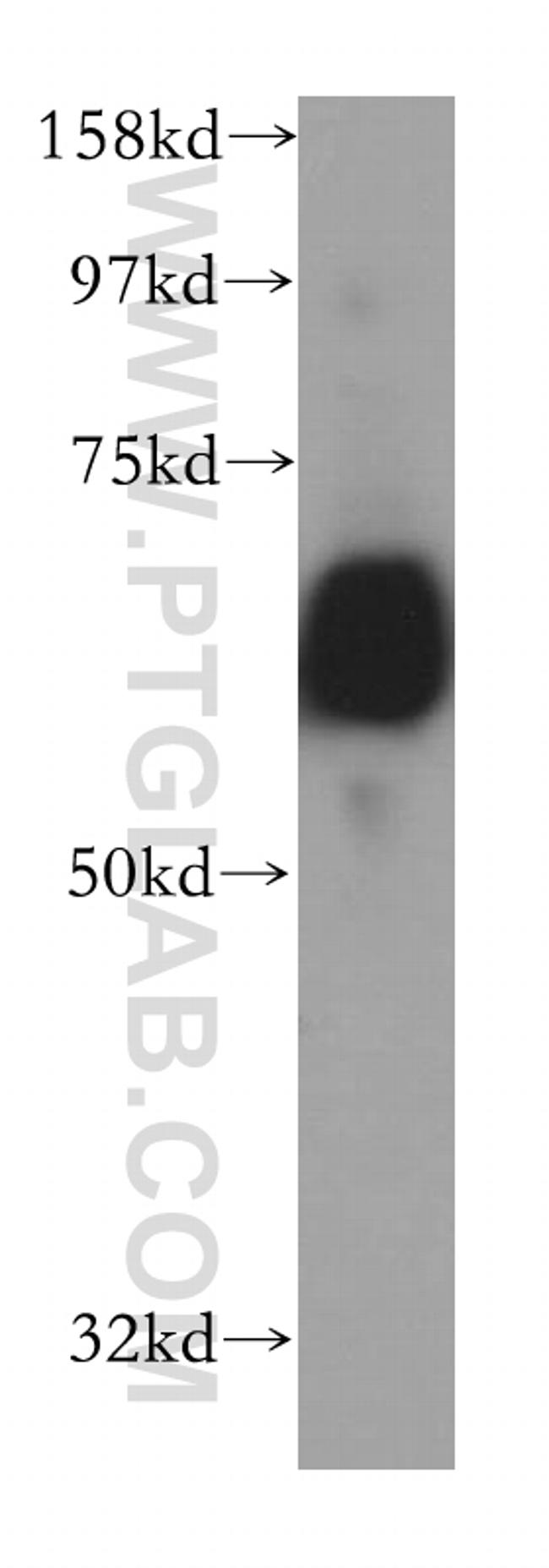 CROT Antibody in Western Blot (WB)