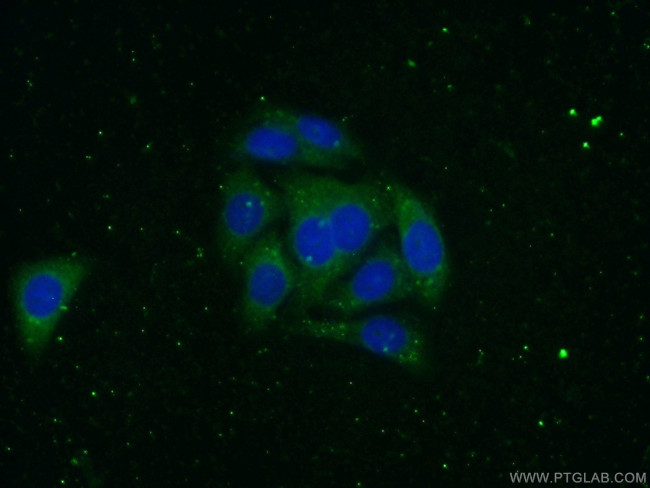 Alpha-2-macroglobulin Antibody in Immunocytochemistry (ICC/IF)