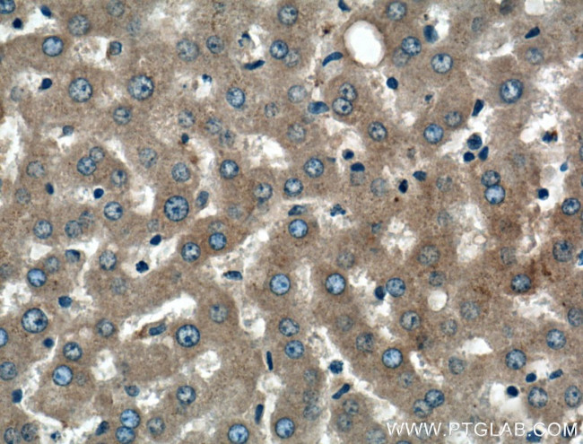 Alpha-2-macroglobulin Antibody in Immunohistochemistry (Paraffin) (IHC (P))