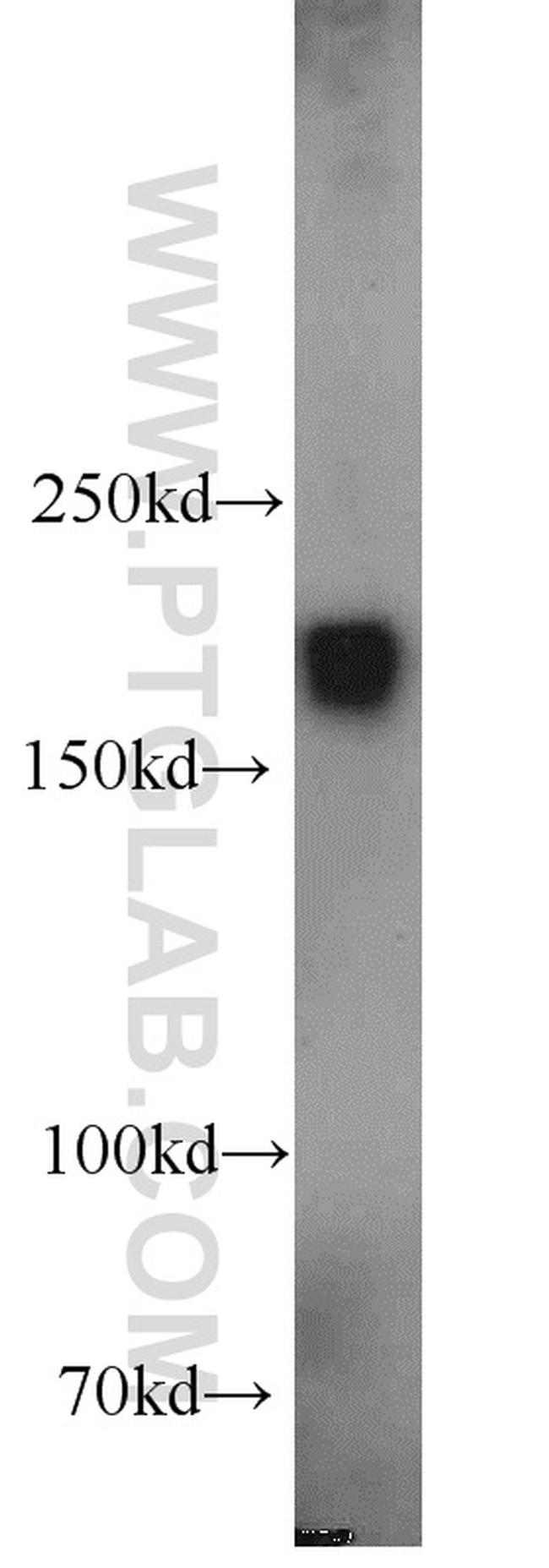 Alpha-2-macroglobulin Antibody in Western Blot (WB)