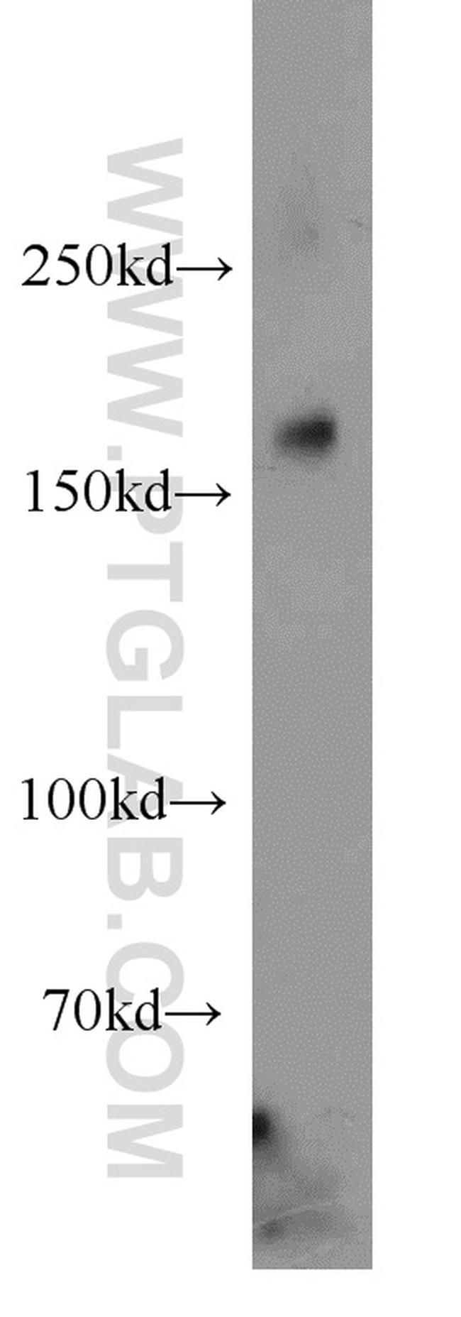 Alpha-2-macroglobulin Antibody in Western Blot (WB)