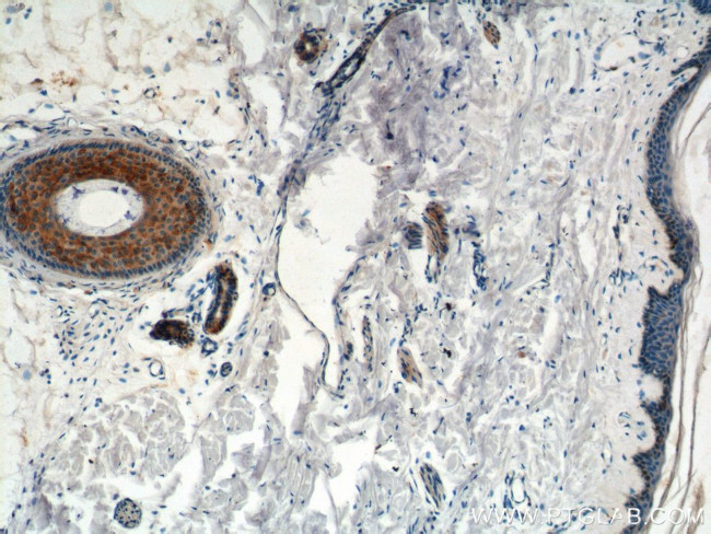 ST3GAL4 Antibody in Immunohistochemistry (Paraffin) (IHC (P))