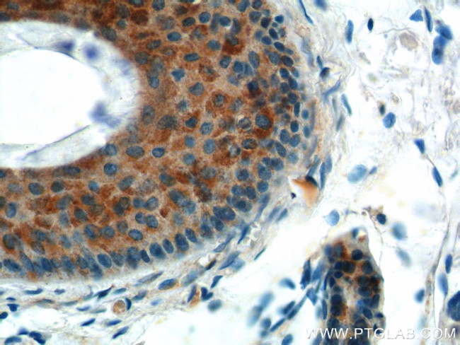 ST3GAL4 Antibody in Immunohistochemistry (Paraffin) (IHC (P))