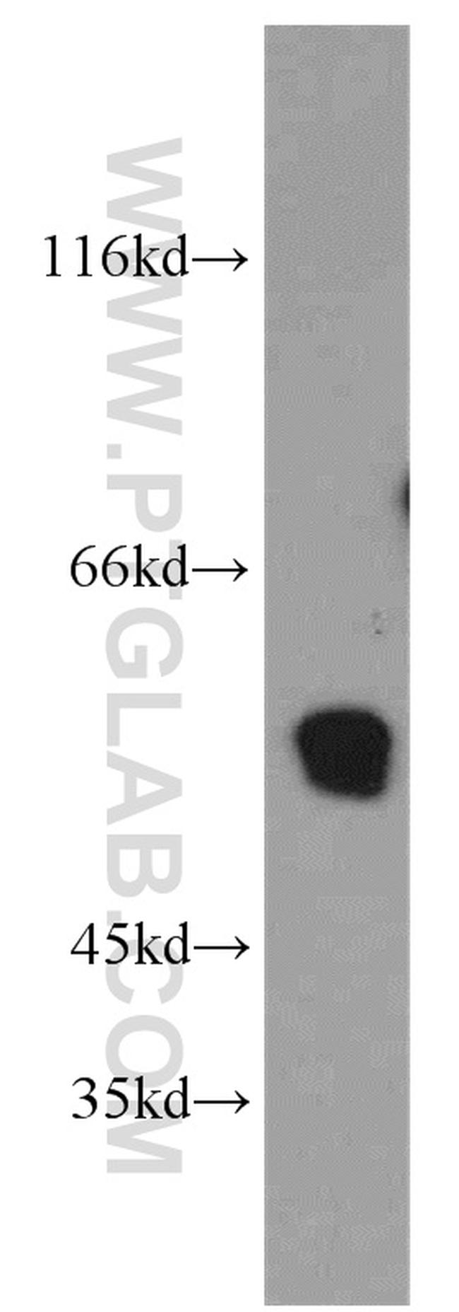 ST3GAL4 Antibody in Western Blot (WB)