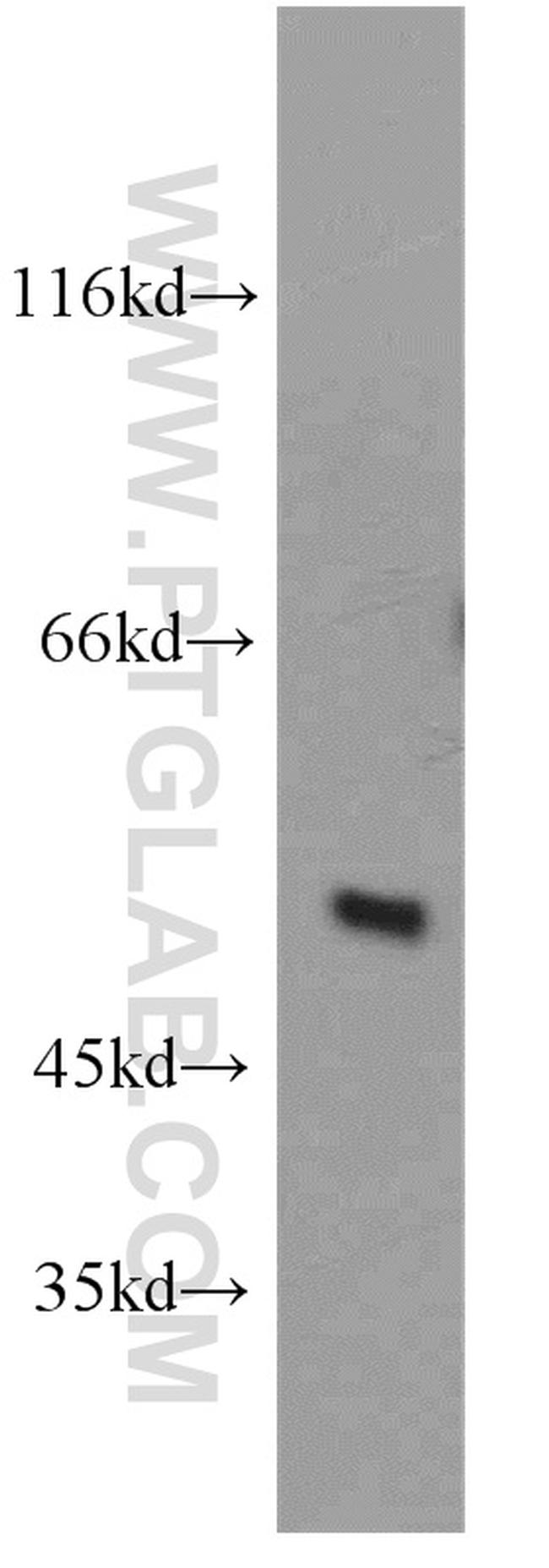 ST3GAL4 Antibody in Western Blot (WB)