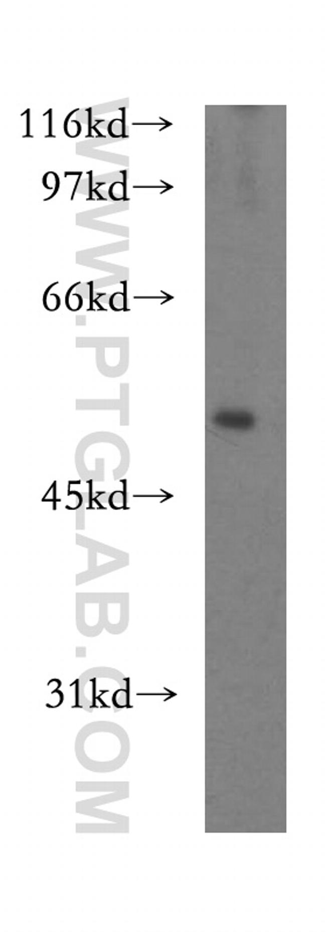 ST3GAL4 Antibody in Western Blot (WB)