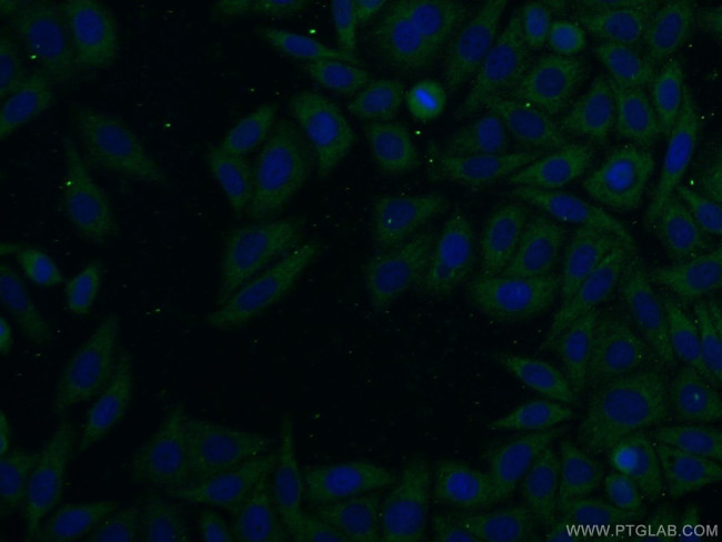 SFI1 Antibody in Immunocytochemistry (ICC/IF)