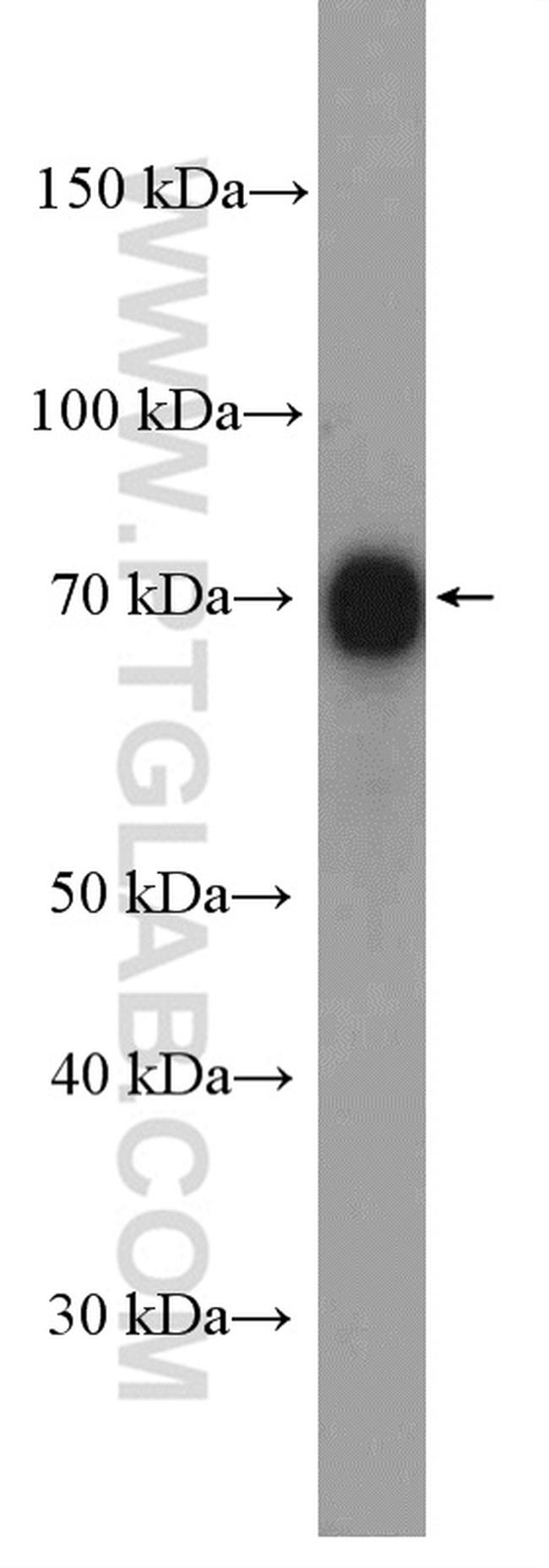 PES1 Antibody in Western Blot (WB)