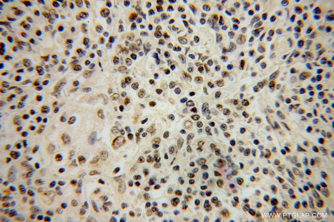 IKZF2 Antibody in Immunohistochemistry (Paraffin) (IHC (P))