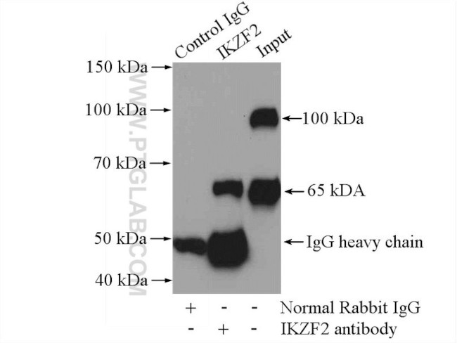 IKZF2 Antibody in Immunoprecipitation (IP)