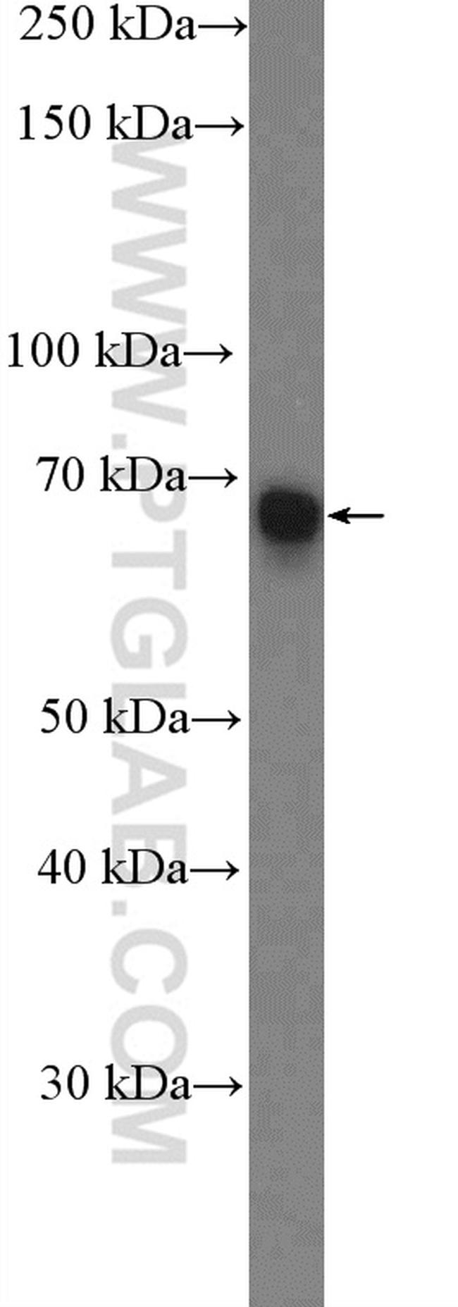 IKZF2 Antibody in Western Blot (WB)