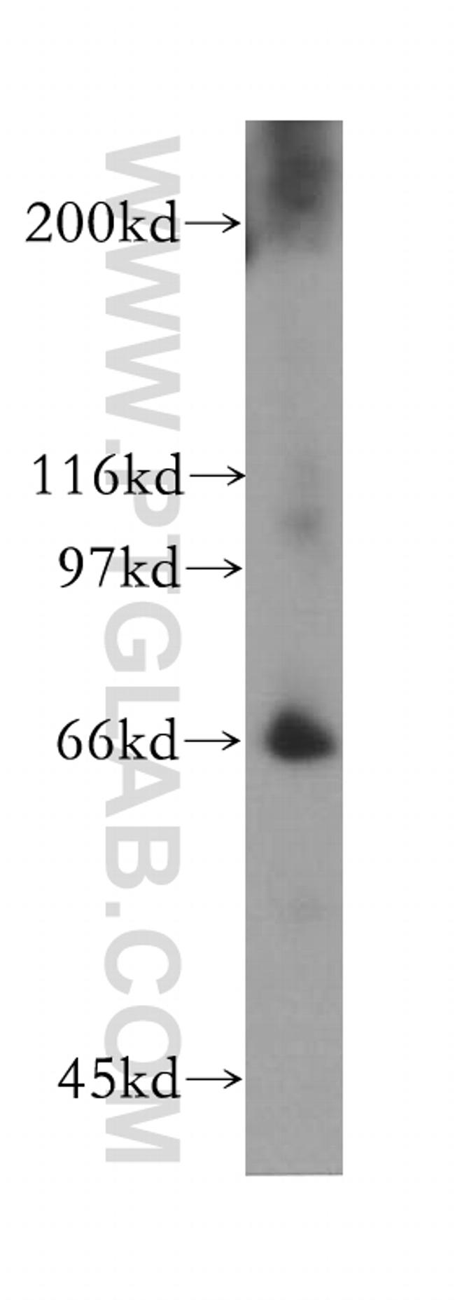 IKZF2 Antibody in Western Blot (WB)