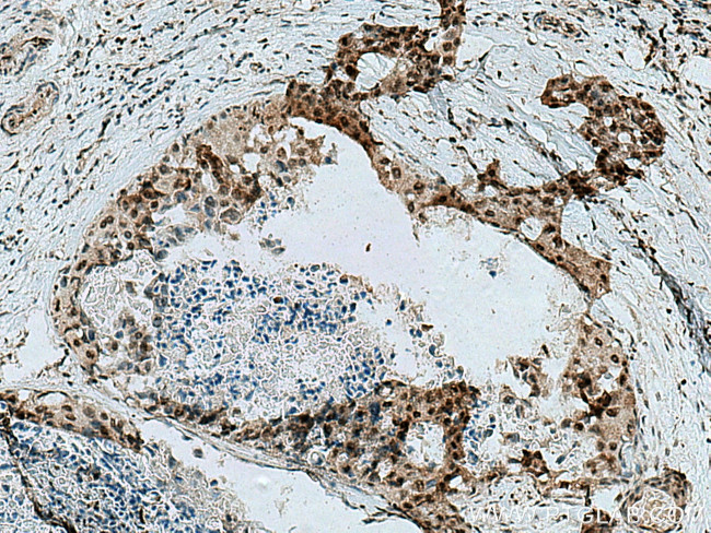 PNKP Antibody in Immunohistochemistry (Paraffin) (IHC (P))