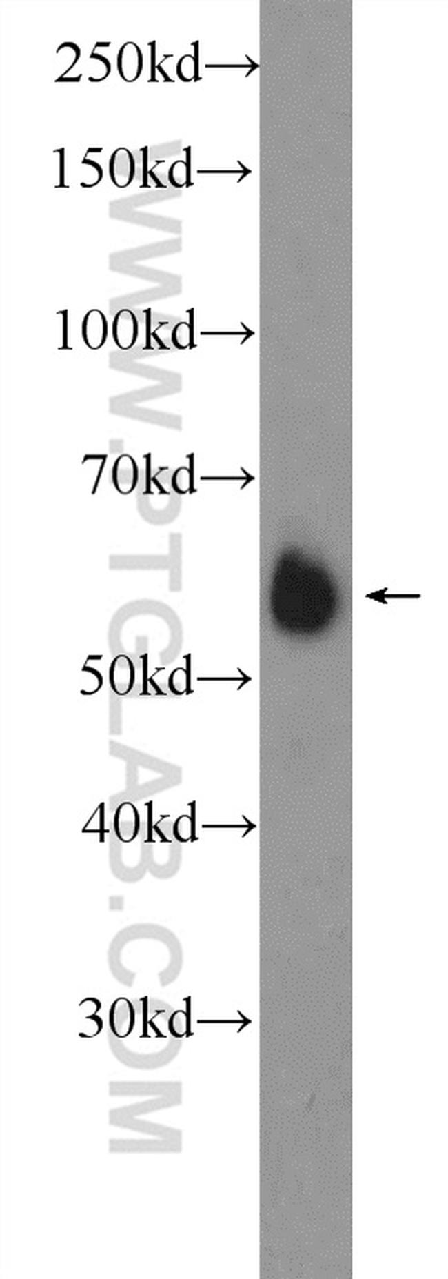 PNKP Antibody in Western Blot (WB)