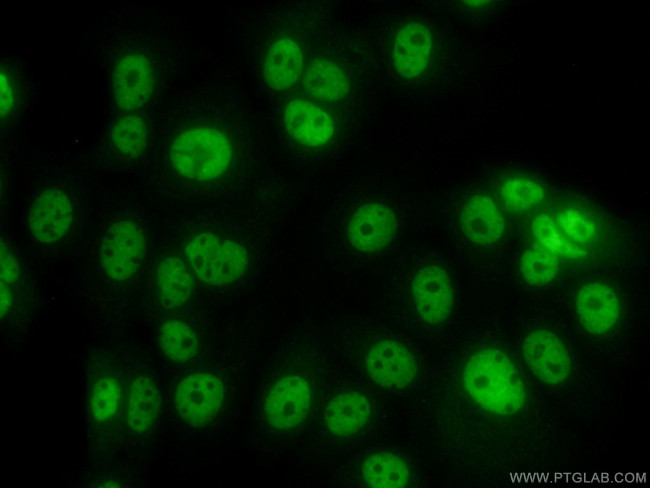 APC2 Antibody in Immunocytochemistry (ICC/IF)