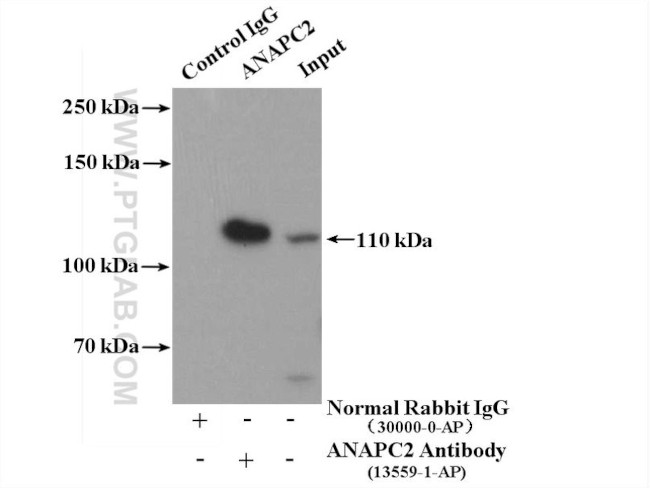 APC2 Antibody in Immunoprecipitation (IP)