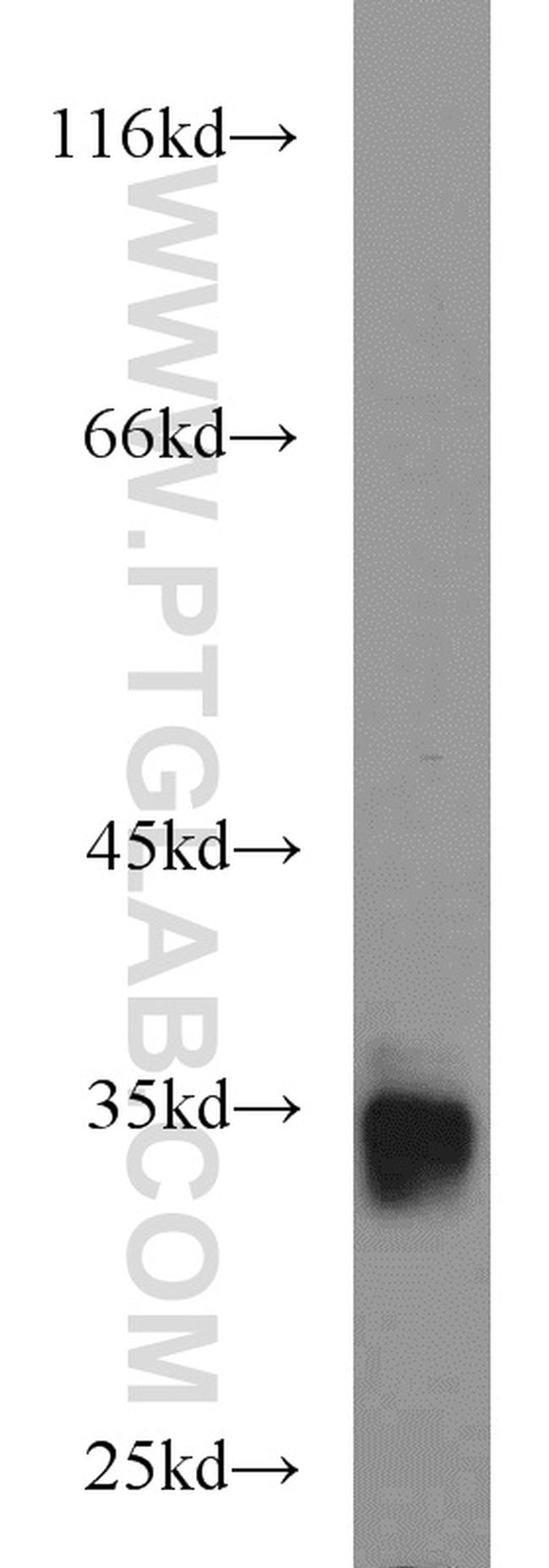 BST2 Antibody in Western Blot (WB)