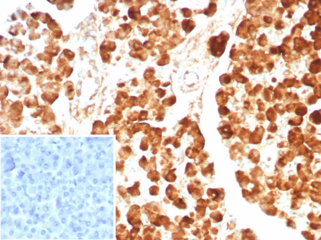 Carboxypeptidase A1/CPA1 (Pancreatic Cancer Marker) Antibody in Immunohistochemistry (Paraffin) (IHC (P))