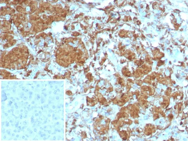 Carboxypeptidase A1/CPA1 (Pancreatic Cancer Marker) Antibody in Immunohistochemistry (Paraffin) (IHC (P))