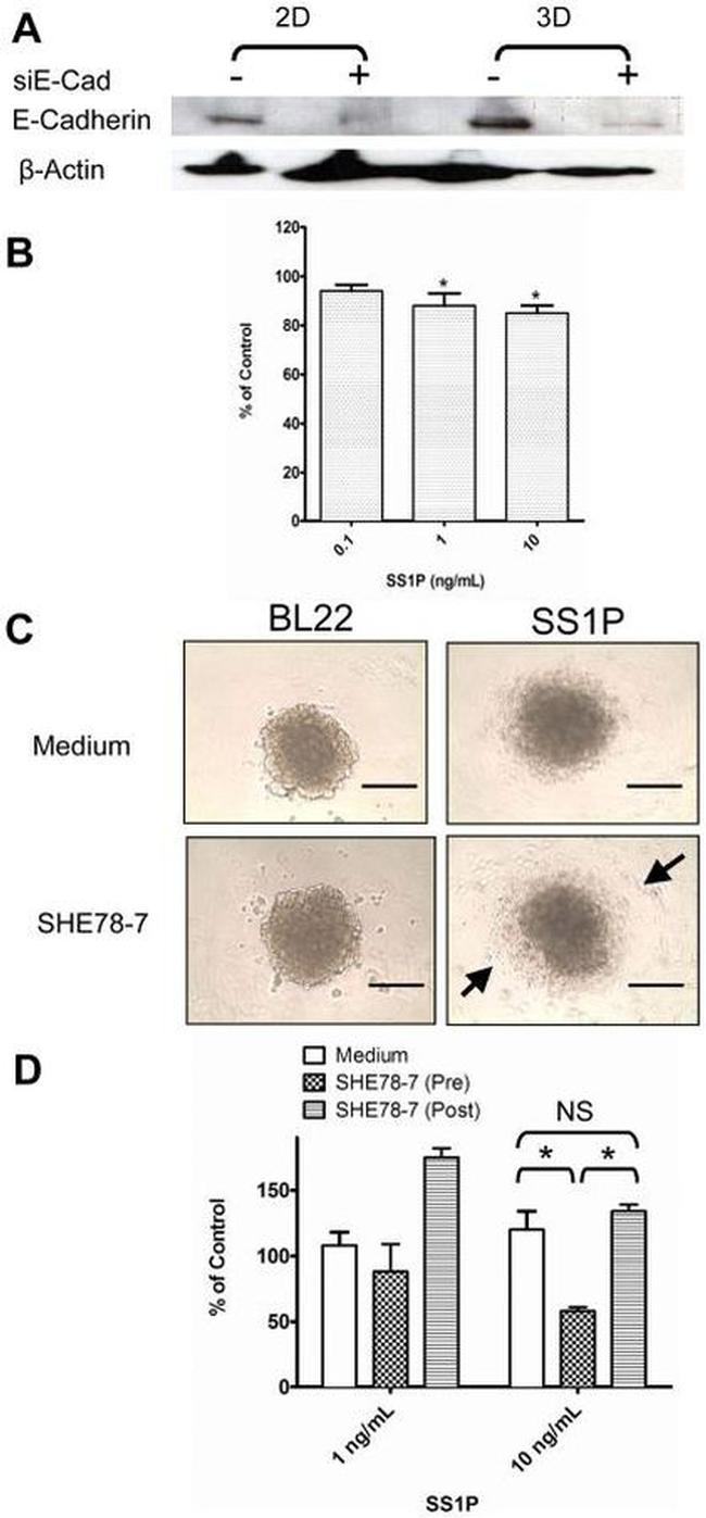 E-cadherin Antibody in Western Blot (WB)