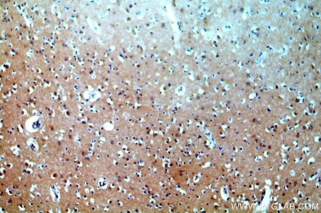 SIRT6 Antibody in Immunohistochemistry (Paraffin) (IHC (P))