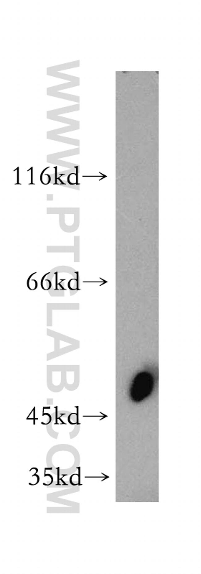 SIRT6 Antibody in Western Blot (WB)