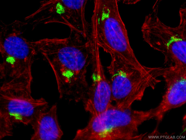 TGN46 Antibody in Immunocytochemistry (ICC/IF)