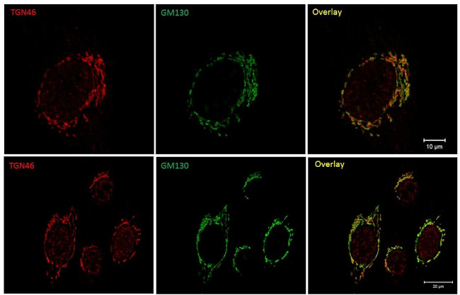 TGN46 Antibody in Immunocytochemistry (ICC/IF)